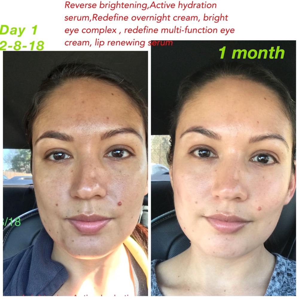 Rodan and Fields consultant